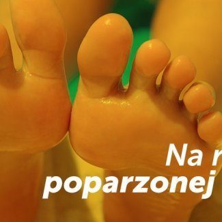 Na ratunek poparzonej skórze