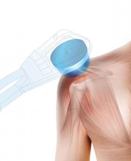 Neu - im Kampf gegen den Schmerz